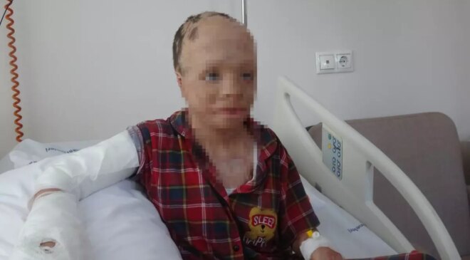 Eymen Asaf Bekci’nin Umut Veren Ameliyatı